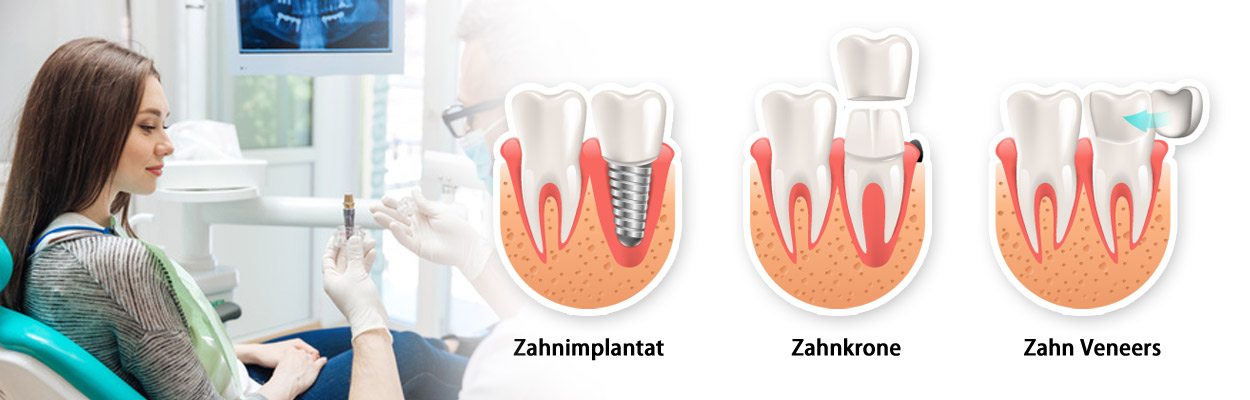 Zahnarzt Munchen Innenstadt Dr Med Dent Wolfgang Hiltscher